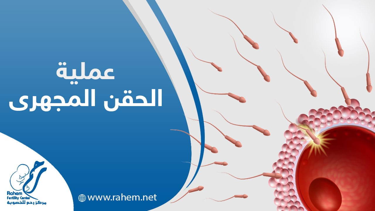 الحويانات المنوية تلقح البويضة اثناء الحقن المجهري